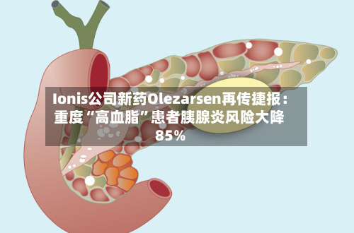 Ionis公司新药Olezarsen再传捷报：重度“高血脂”患者胰腺炎风险大降85%-第2张图片